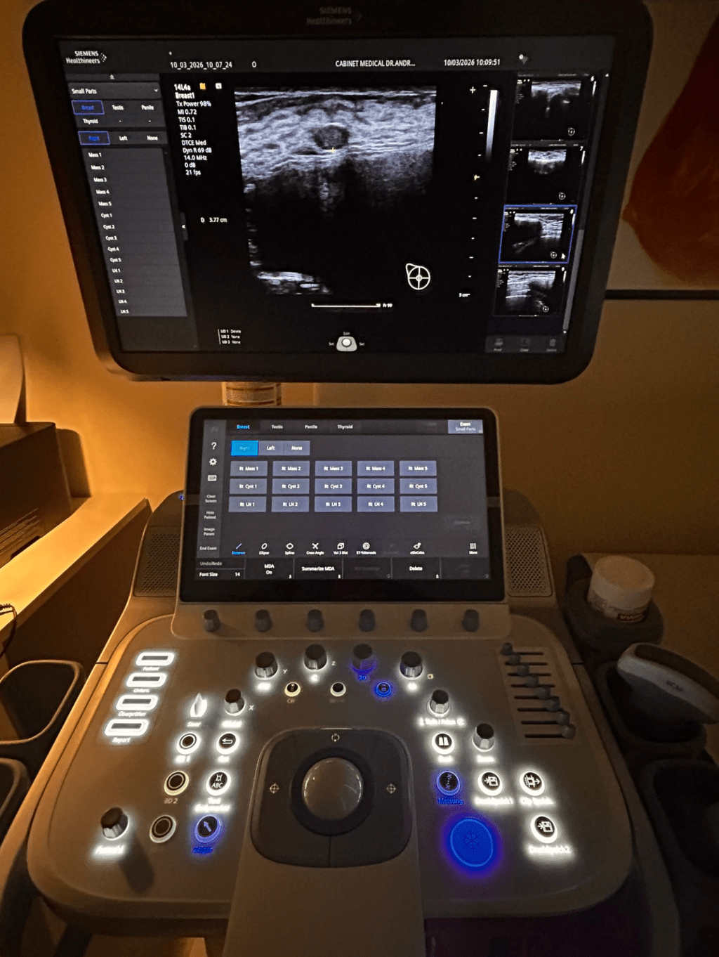 Implantul mamar și ecografia mamară – când este&nbsp;necesară?