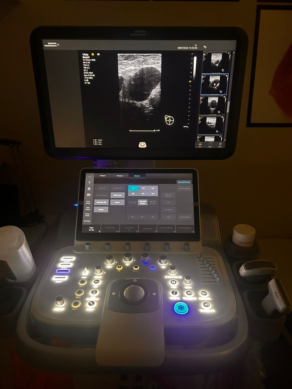Existã cancer de sân fãrã tumorã primarã mamarã identificabilã&nbsp;imagistic?